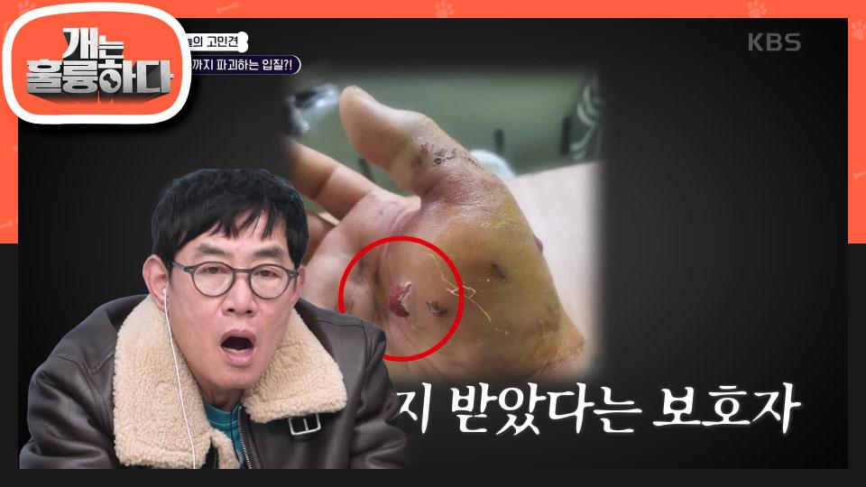 ＂물려서 근육 봉합술을 했습니다＂ 어느 날 제작진에게 접수된 제보 한 통!?😨 | KBS 240226 방송 